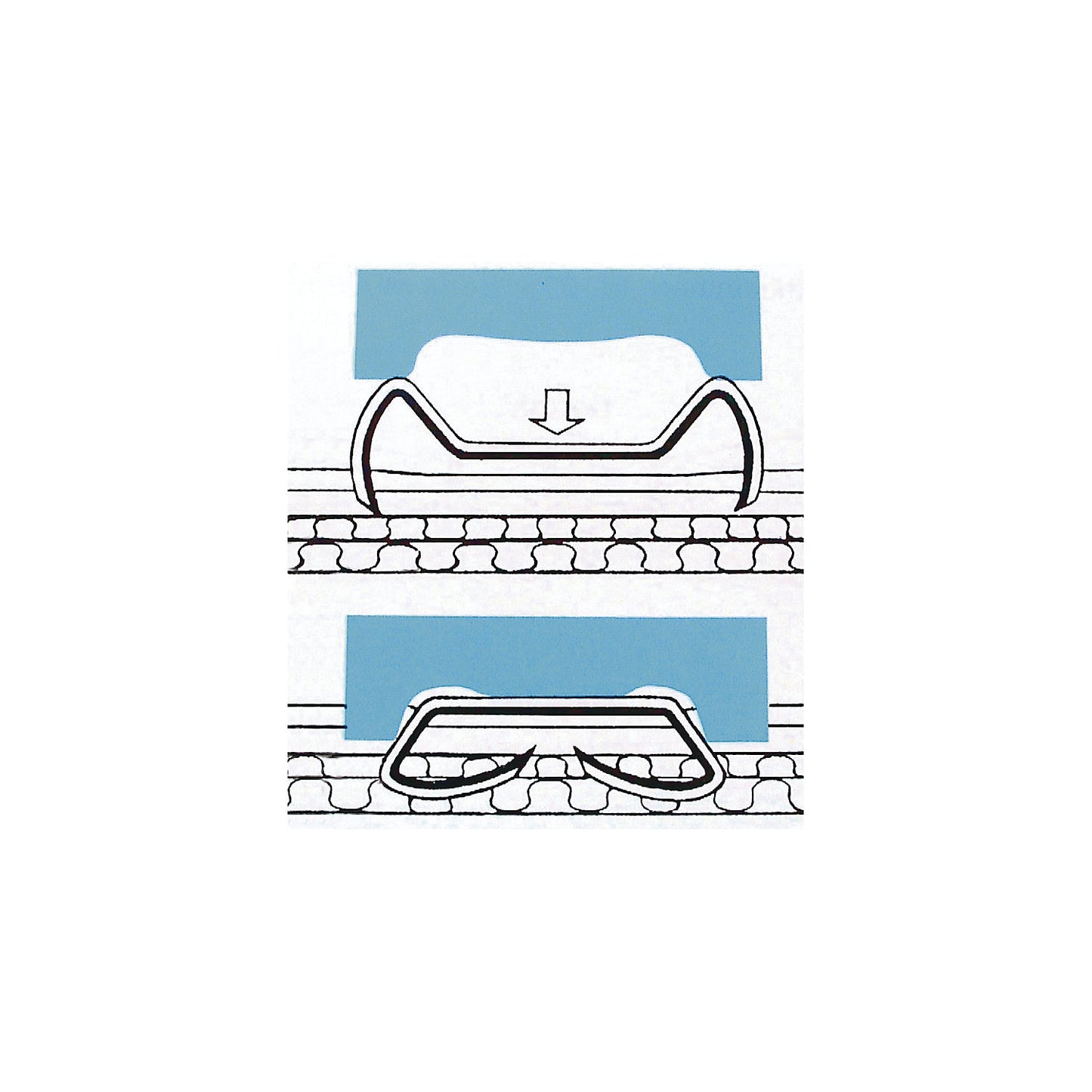 Staples for handheld sealing stapler for blind stapling, pack of 20000, leg length 18 mm.